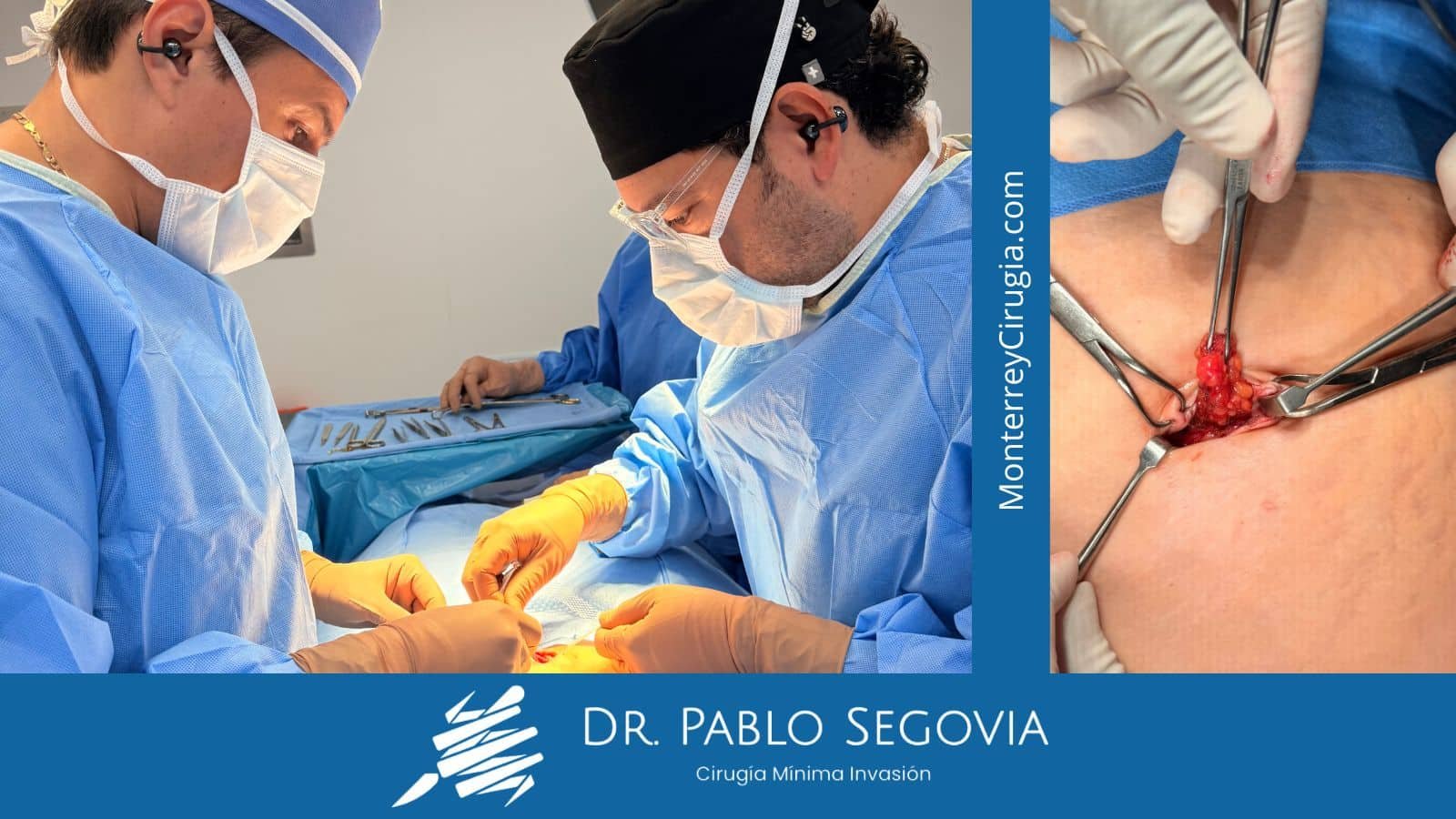 Dr. Pablo Segovia revisando hernia umbilical a paciente adulto en Monterrey